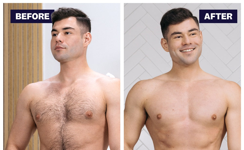 Should Men Shave Their Chest Hair?