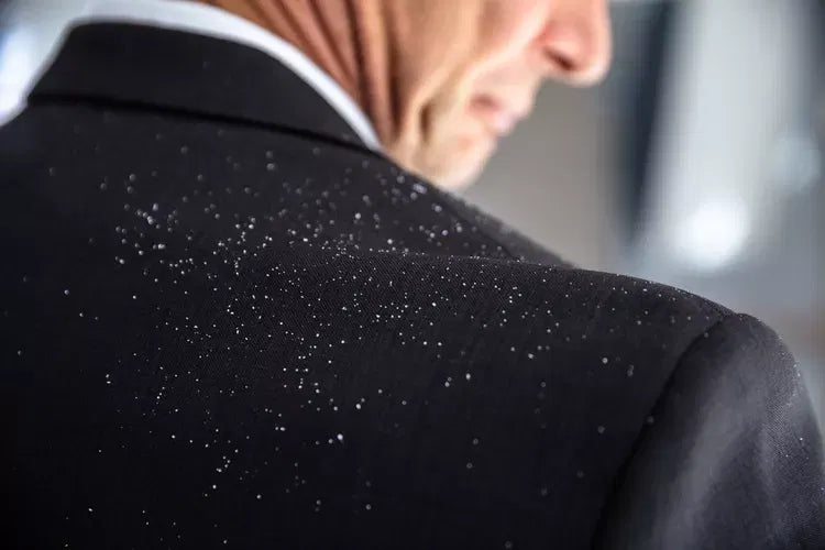 Dry Scalp vs. Dandruff: What's the Difference? (With Pictures)