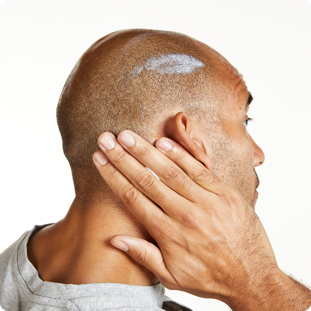 Scalp Care card image