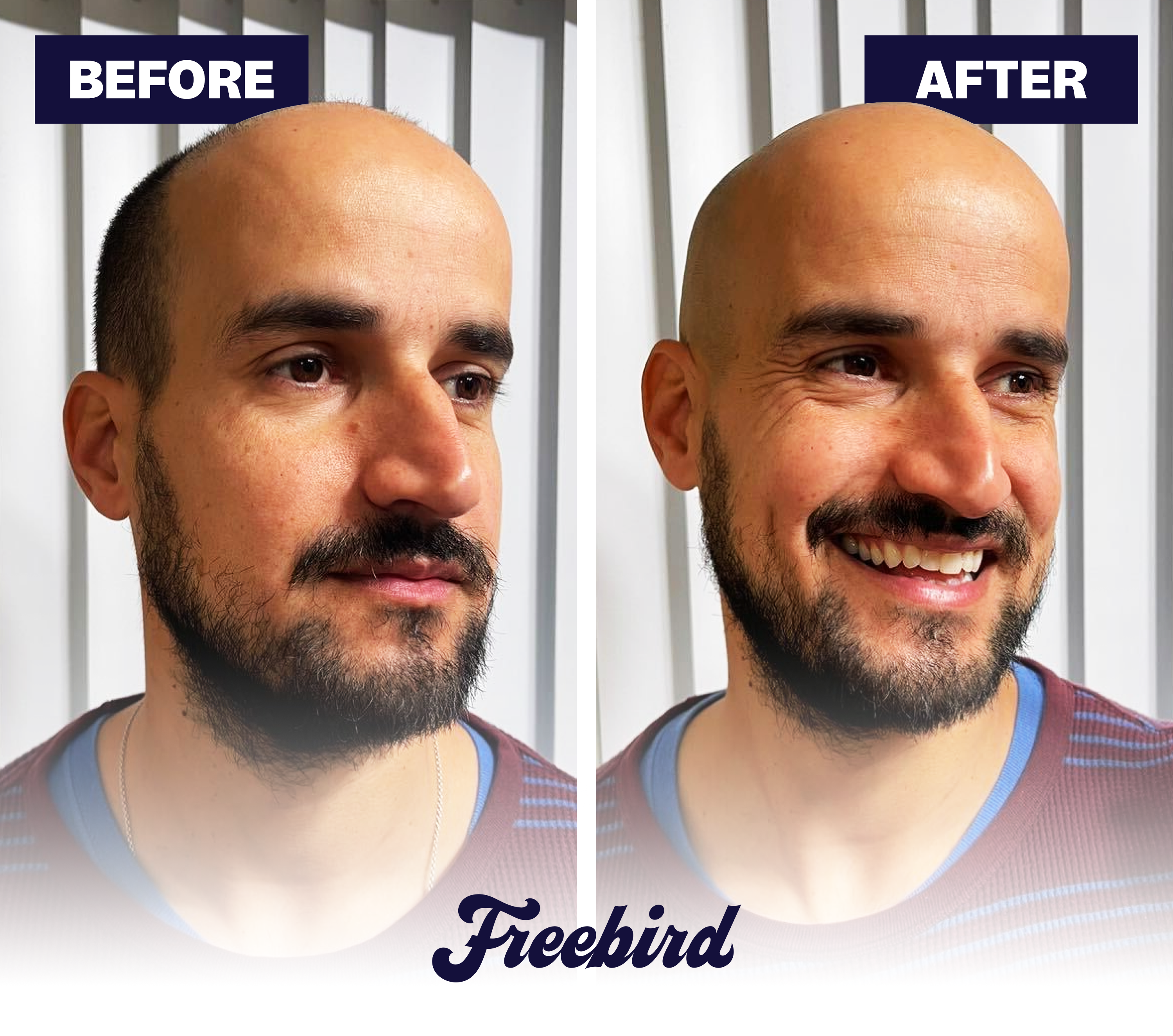Side-by-side photos of a man before and after using the Freebird FlexSeries® Shaving Kit, with Freebird below.