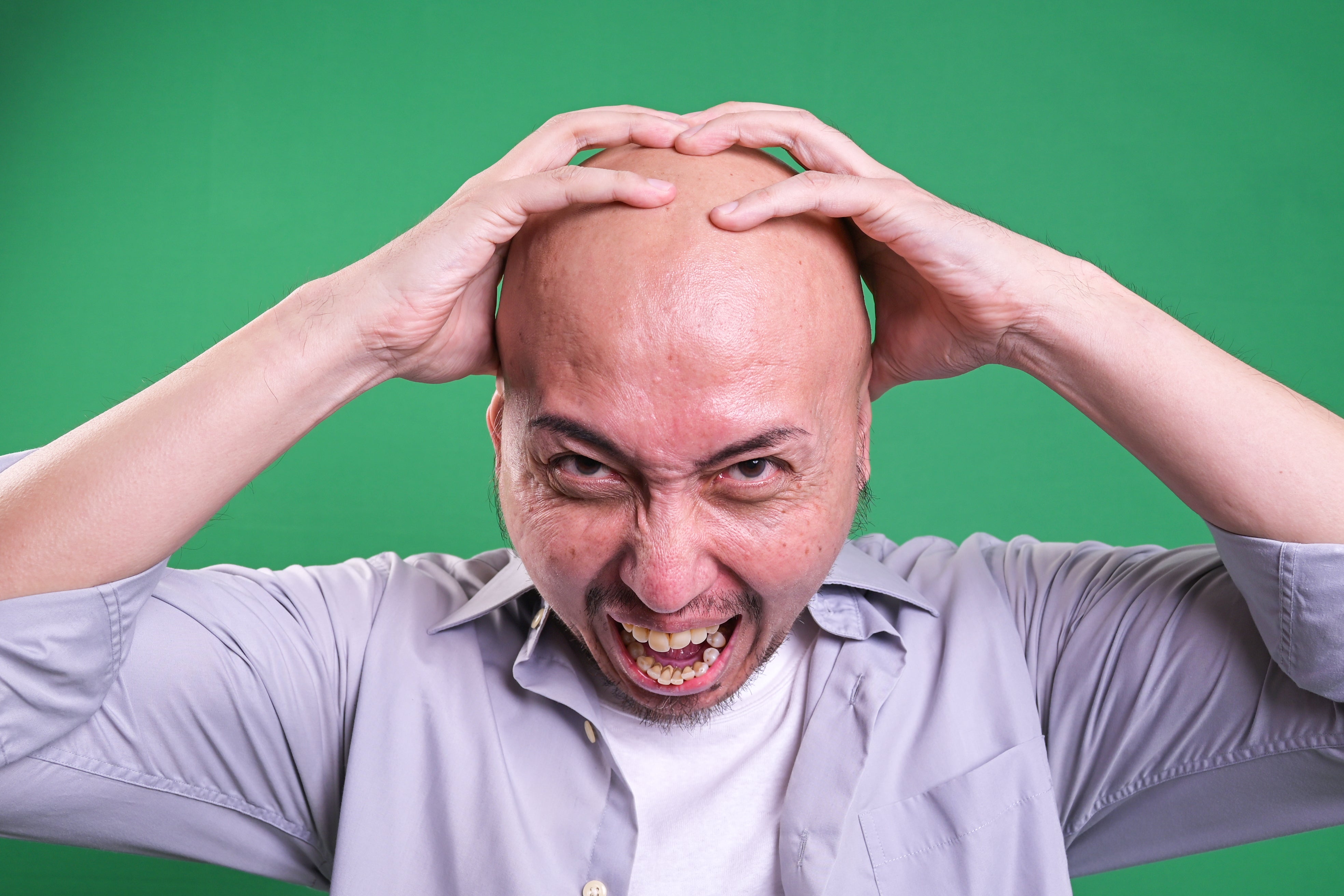 bald man holding scalp in pain