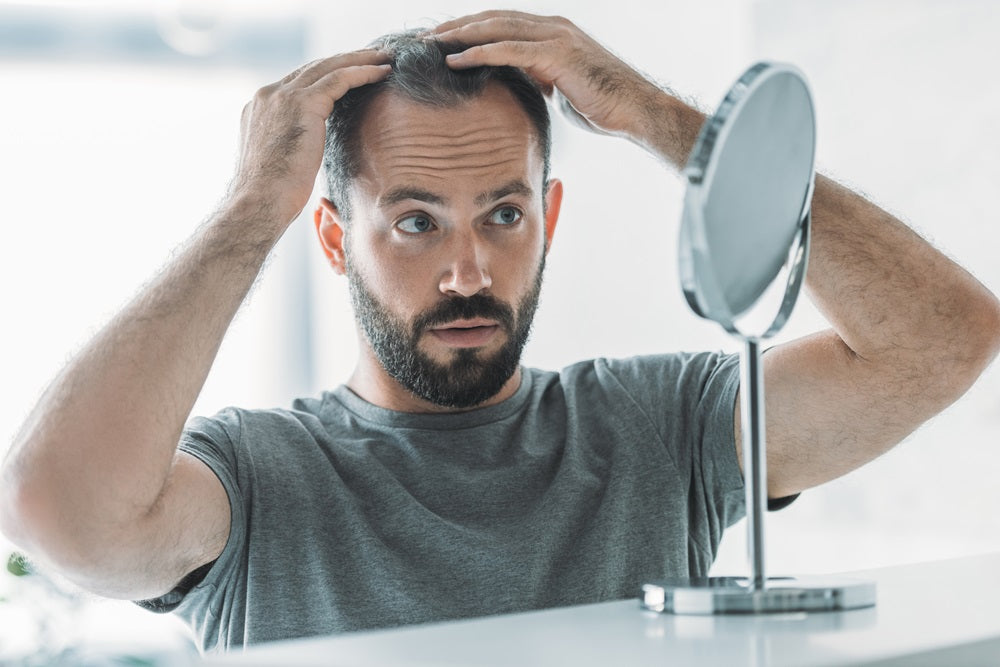 The Norwood Scale: Stages of Male Pattern Hair Loss