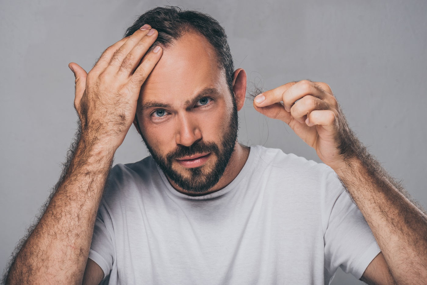man checking hairline and holding a strand of hair