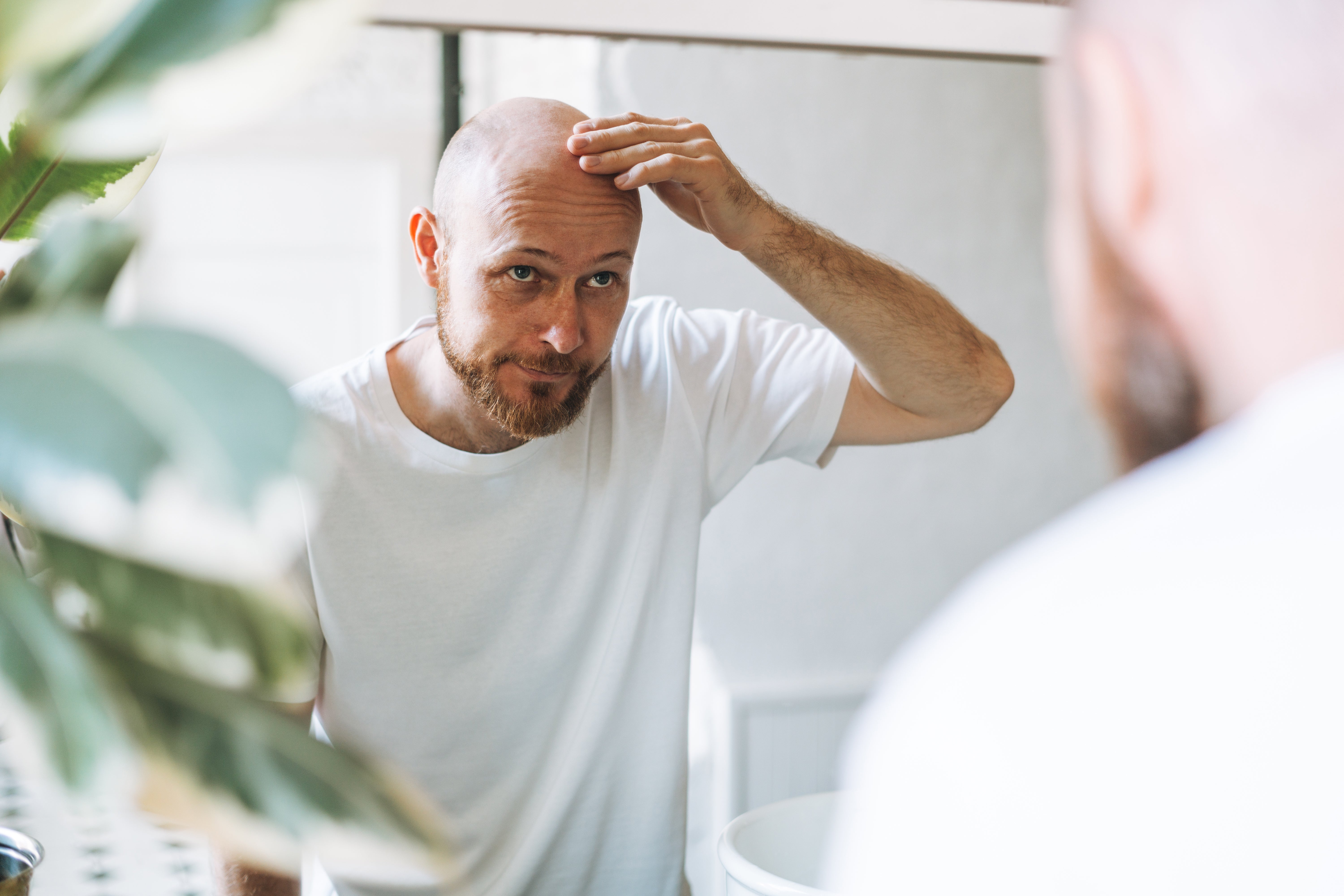 What I Wish I Knew Before Shaving My Head - According to Baldies