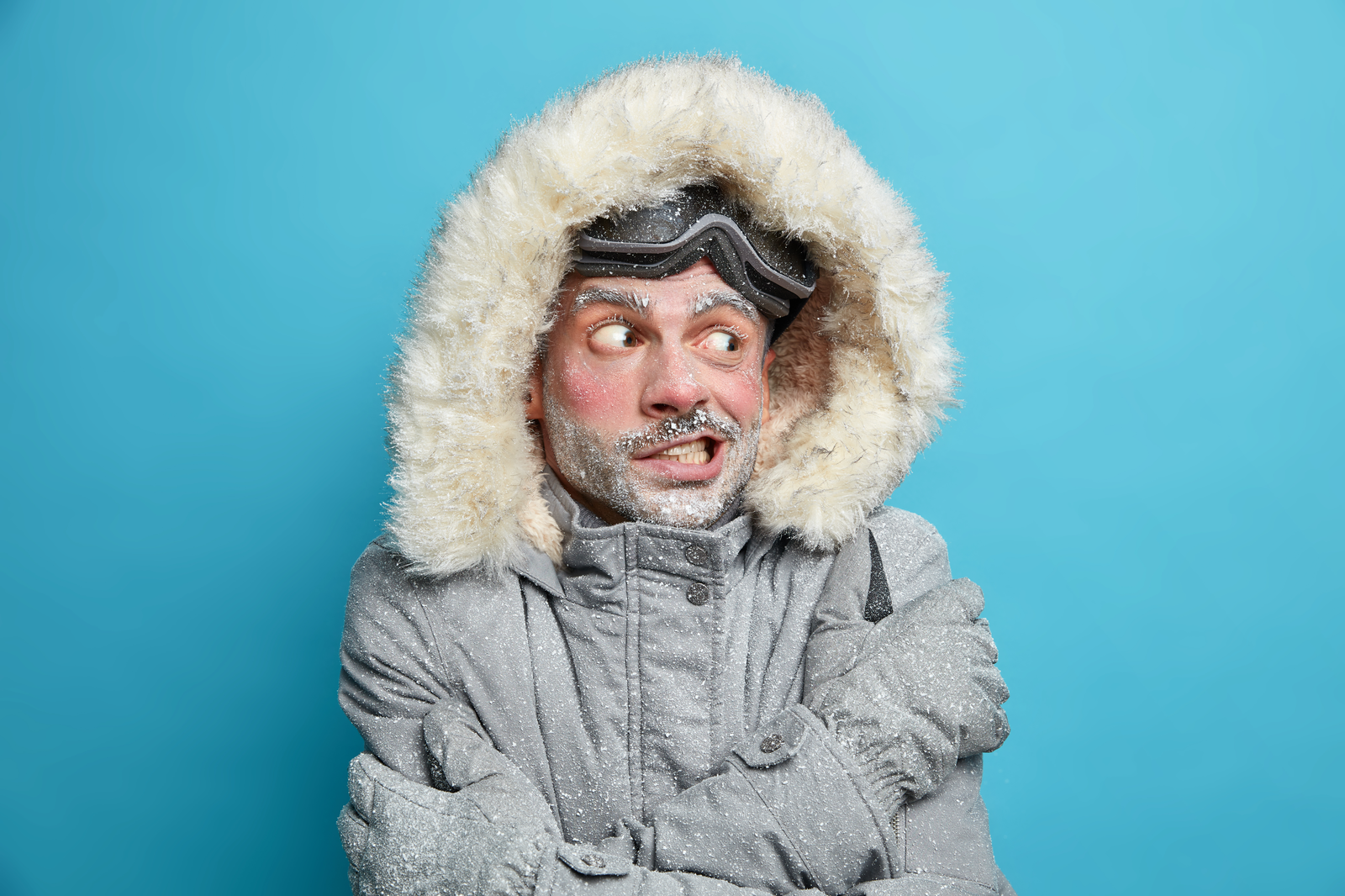Do Bald People's Heads Get Cold?
