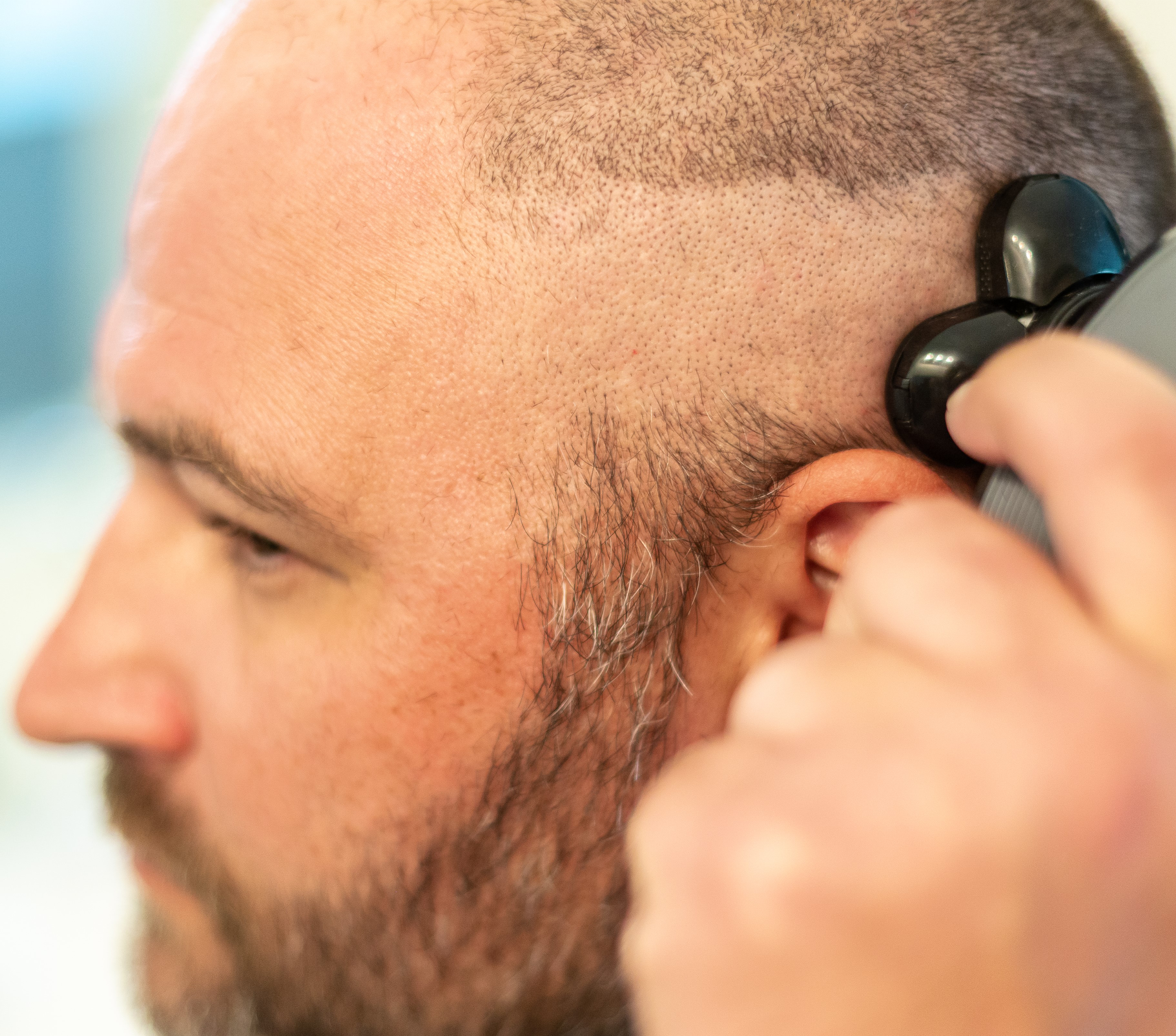 A man uses the Freebird FlexSeries® Shaving Kit with ScalpSafe™ Technology for a smooth shave above his ear.