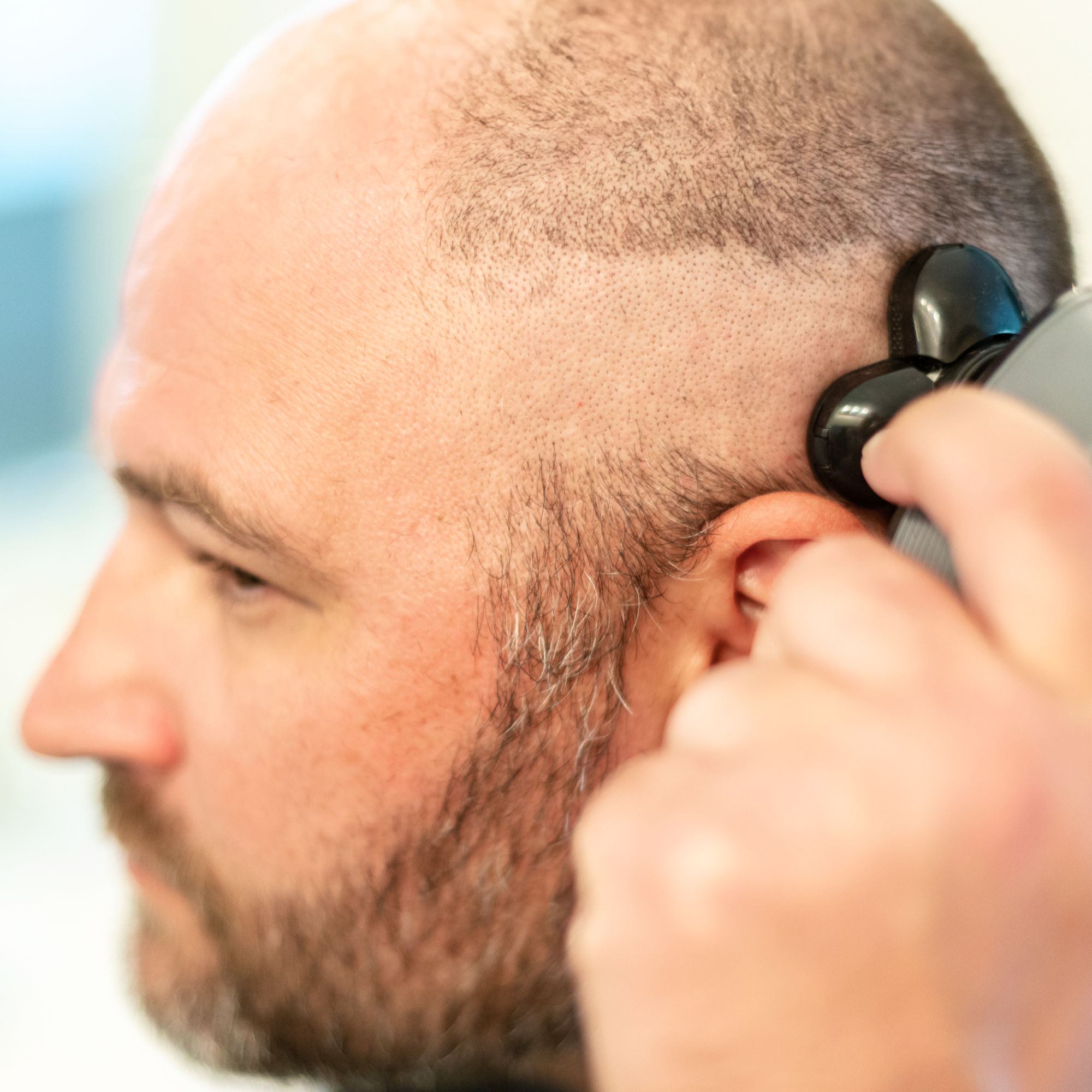 Using the FlexSeries® Shaving Kit by Freebird, a man expertly shaves the side of his head near the ear with ease and precision. The ScalpSafe Technology ensures a smooth, dry shave while the blurred background emphasizes his concentration and skill.